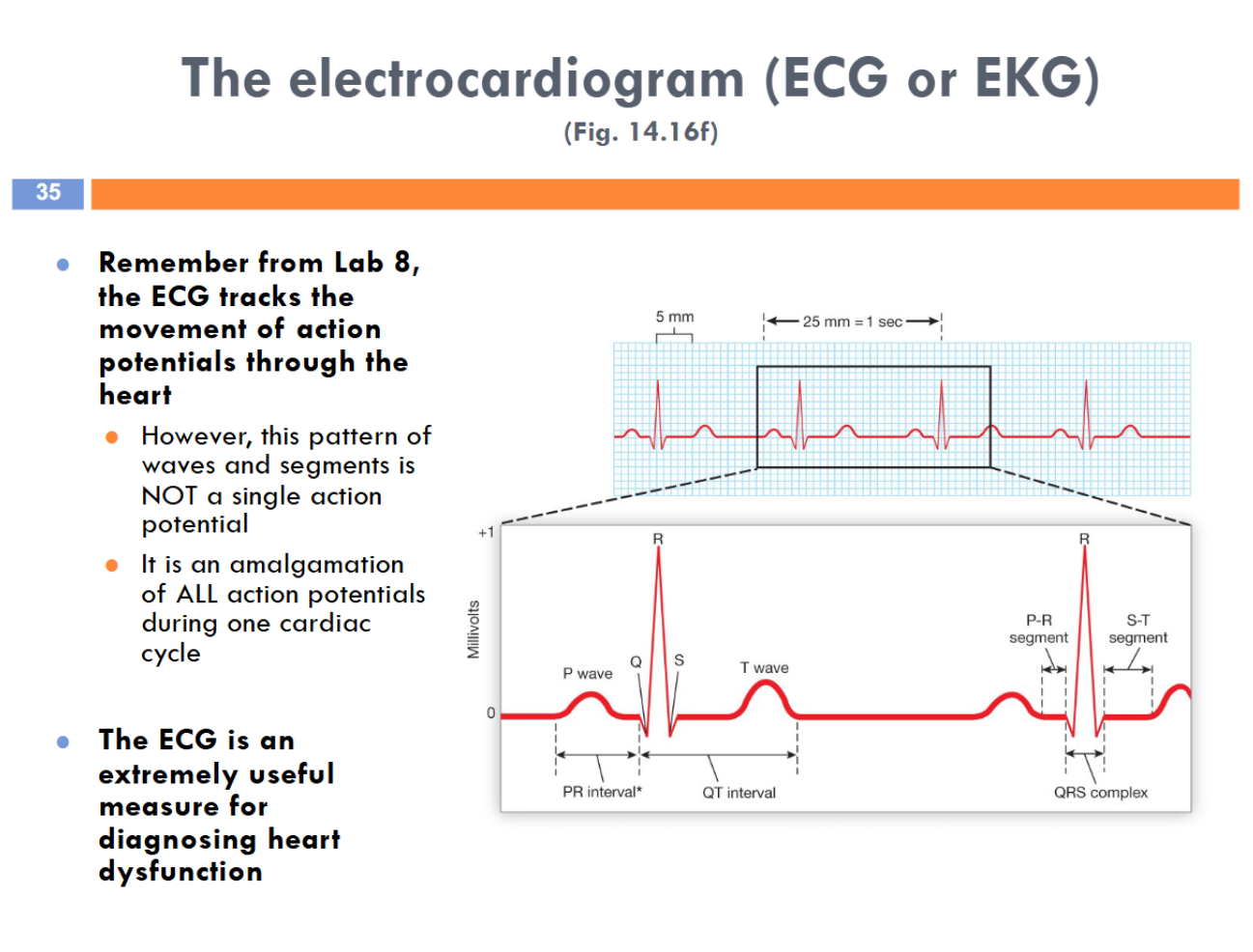 <p>Electrocardiogram</p>