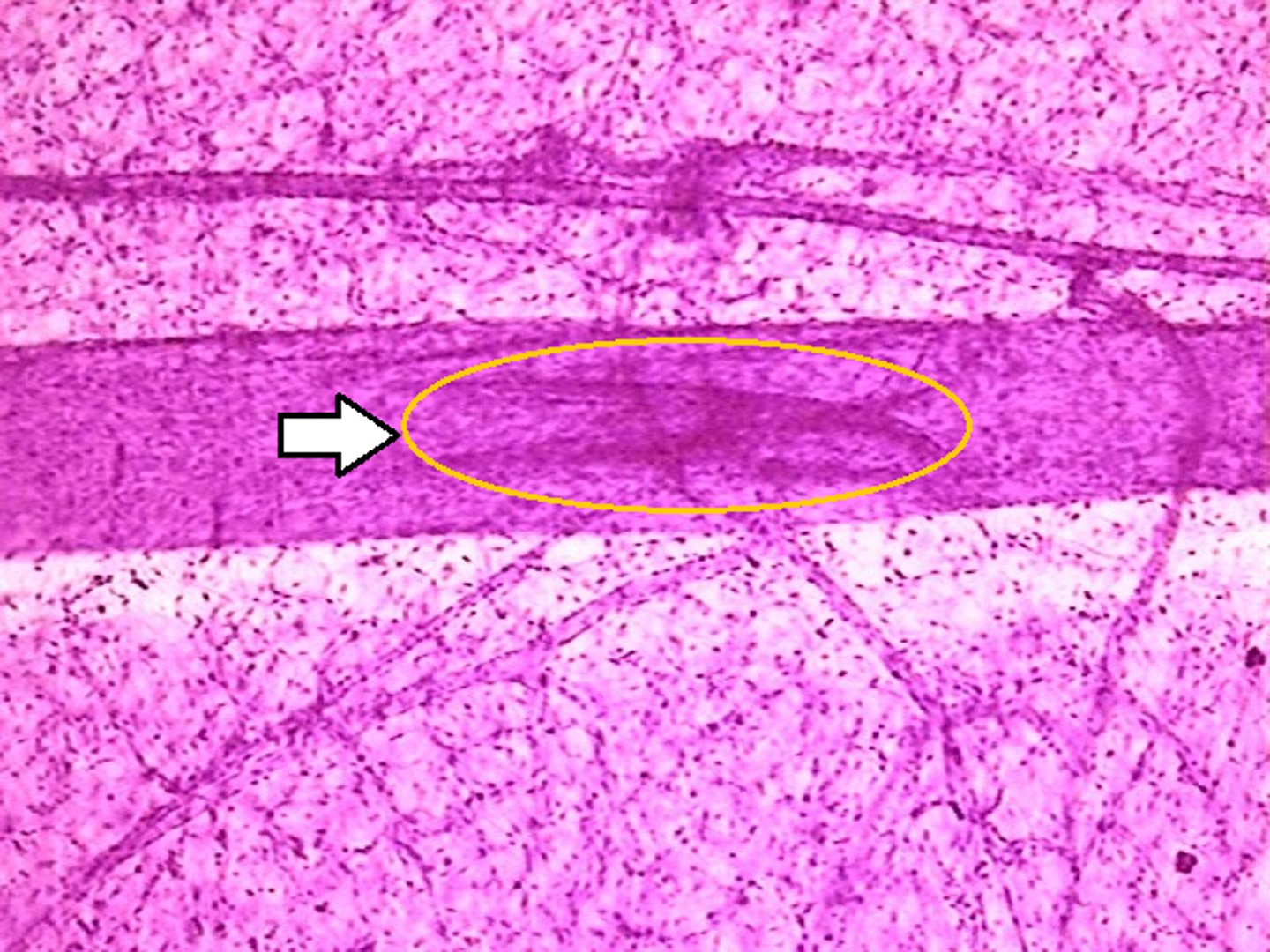 <p>What is being showcased histologically?</p>