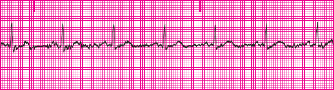<p>What rhythm is this?</p>