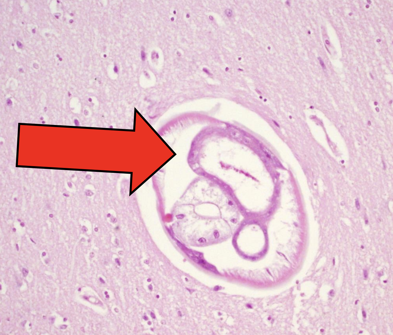 <p>name the structure the red arrow is pointing at? </p>