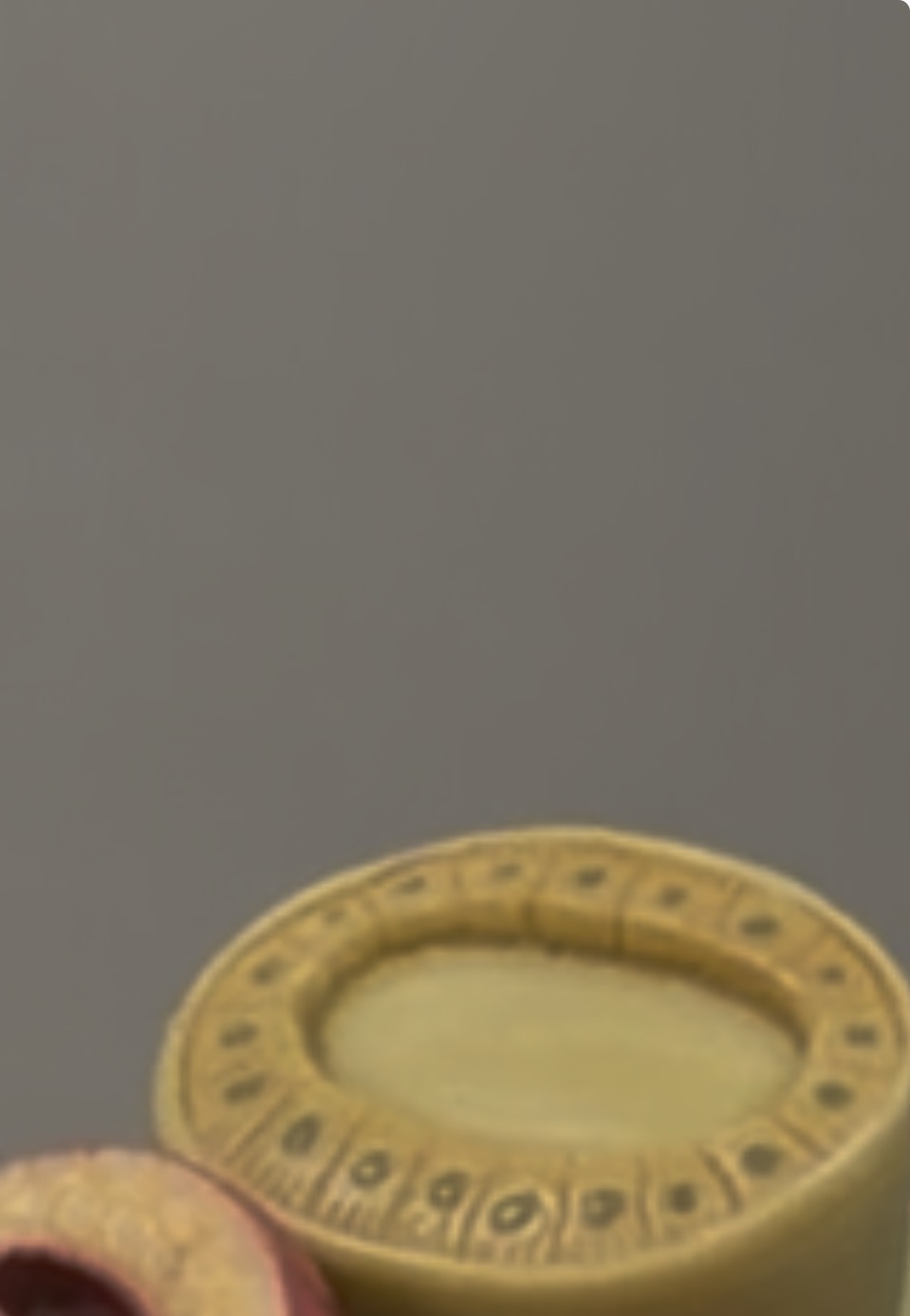 <p>Distal convoluted tubule shown blown in corpuscle</p>