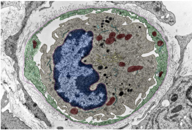 <p>Identify the vessel</p>