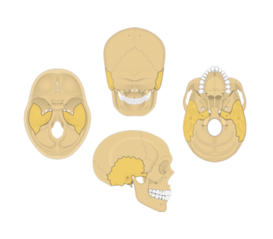 <p>A cranial bone containing the external acoustic meatus, mandibular fossa, and various processes.</p>