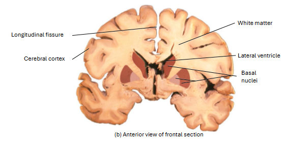 <ul><li><p>section of cerebrum that connects the R and L hemispheres</p></li></ul><ul><li><p>white C-shaped structure located just above the diencephalon</p></li></ul><p></p>