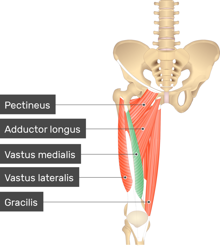 <p>Proximal Attachment (O): Intertrochanteric line and medial lip of linea aspera of femur</p><p>Distal Attachment (I): Via common tendinous (quadriceps tendon) and independent attachments to base of patella; indirectly via patellar ligament to tibial tuberosity; medial and lateral vasti also attach to tibia and patella via aponeuroses (medial and lateral patellar retinacula).</p><p>Nerve: Femoral nerve (L2, L3, L4)</p><p>Action: Extends knee joint; rectus femoris also steadies hip joint and helps iliopsoas flex hip joint.</p>