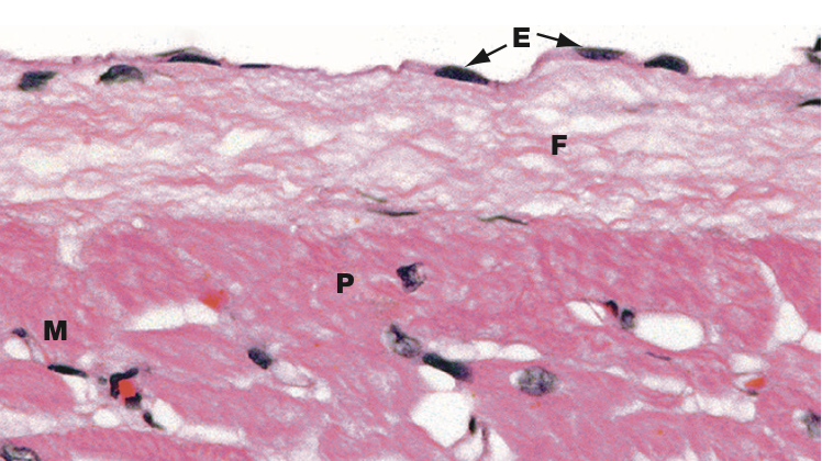 <p>Identify Which partition this is and Where?</p>