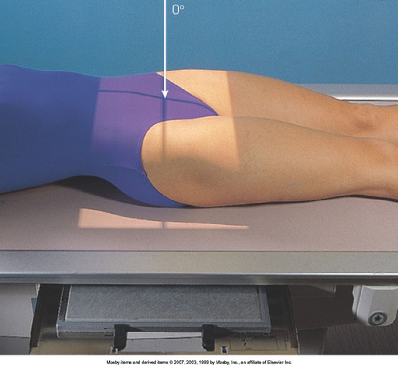 <p>S - none</p><p>T - 25 mAs @ 75 kVp</p><p>A - none</p><p>M - correct marker on correct side</p><p>P - PT supine w/ toes TP, CR 2" below ASIS</p><p>S - 40"</p><p>B - suspension</p><p>C - 14 x 17 crosswise</p>