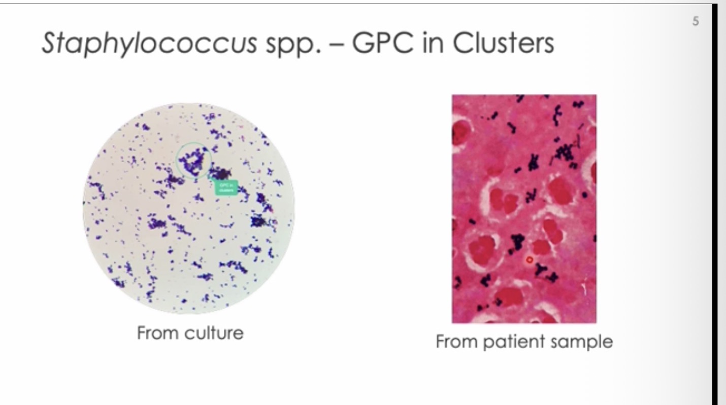 <p>Gram+ Cocci in clusters</p><p>Catalase Positive</p>