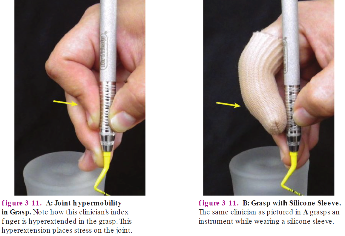 <p><strong>Joint stabilizing devices for hypermobility clinicians</strong></p>