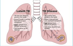 <p>No symptoms (can't infect others)</p>