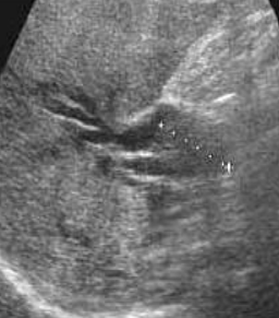 <p>what is shown in this image</p>