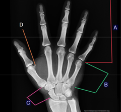 <p>A?</p>