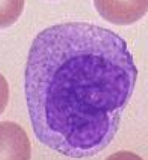 <p>What blood cell is this?</p>
