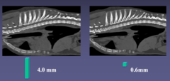 <p>thicker slices cause a loss of spatial resolution, therefore an isotopic voxel should be used.</p>