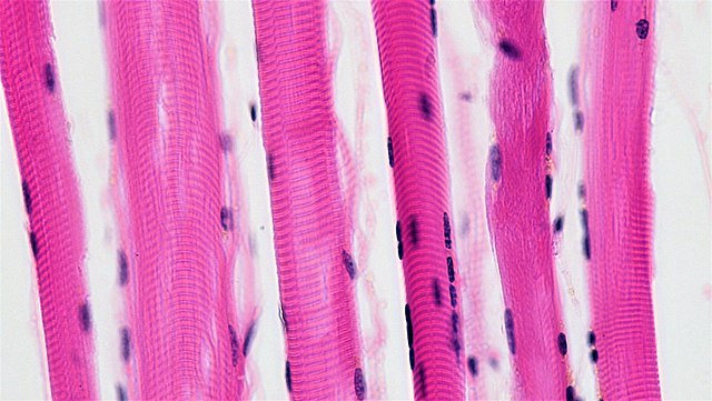 <p>what type of muscle tissue is this (looks like bacon)?</p>