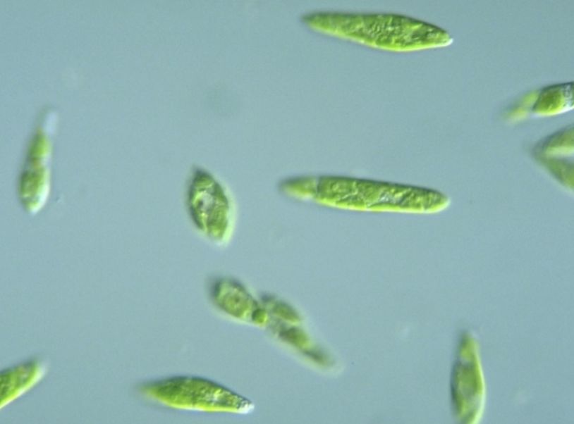 <p>What protist is this?</p>