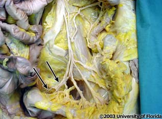 <p>what artery is pictured (context, loops of the small intestine have been removed)?</p>