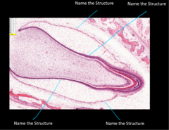 <p>Name the structure (innermost line)</p><p>Separated from connective tissue by basal lamina</p>