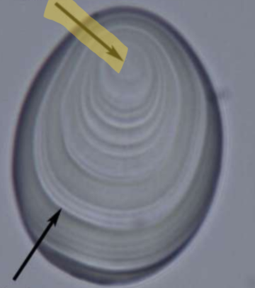 <p>Identify the feature of the highlighted arrow</p>