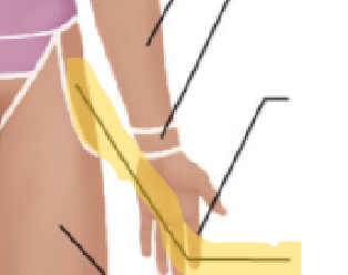 <p>What term is this? </p>
