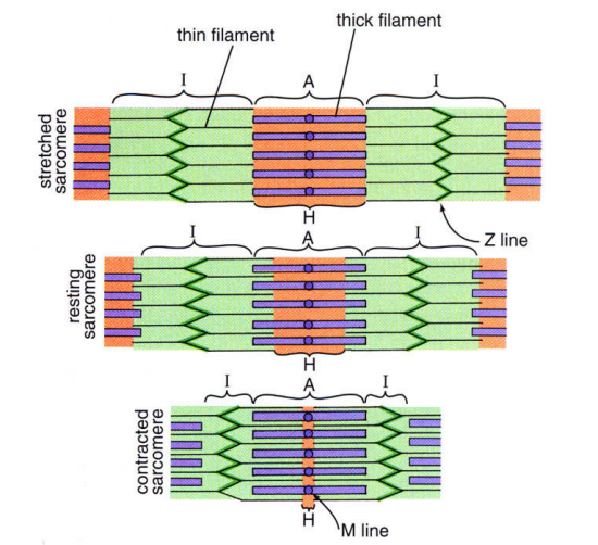 <p><span style="font-family: "Times New Roman";">dark band, zone <strong>occupied by the thick filament and overlapping part of thin filament</strong></span></p>