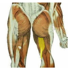 <p>What muscle is the highlighted region depicting? what is its innervation?</p>