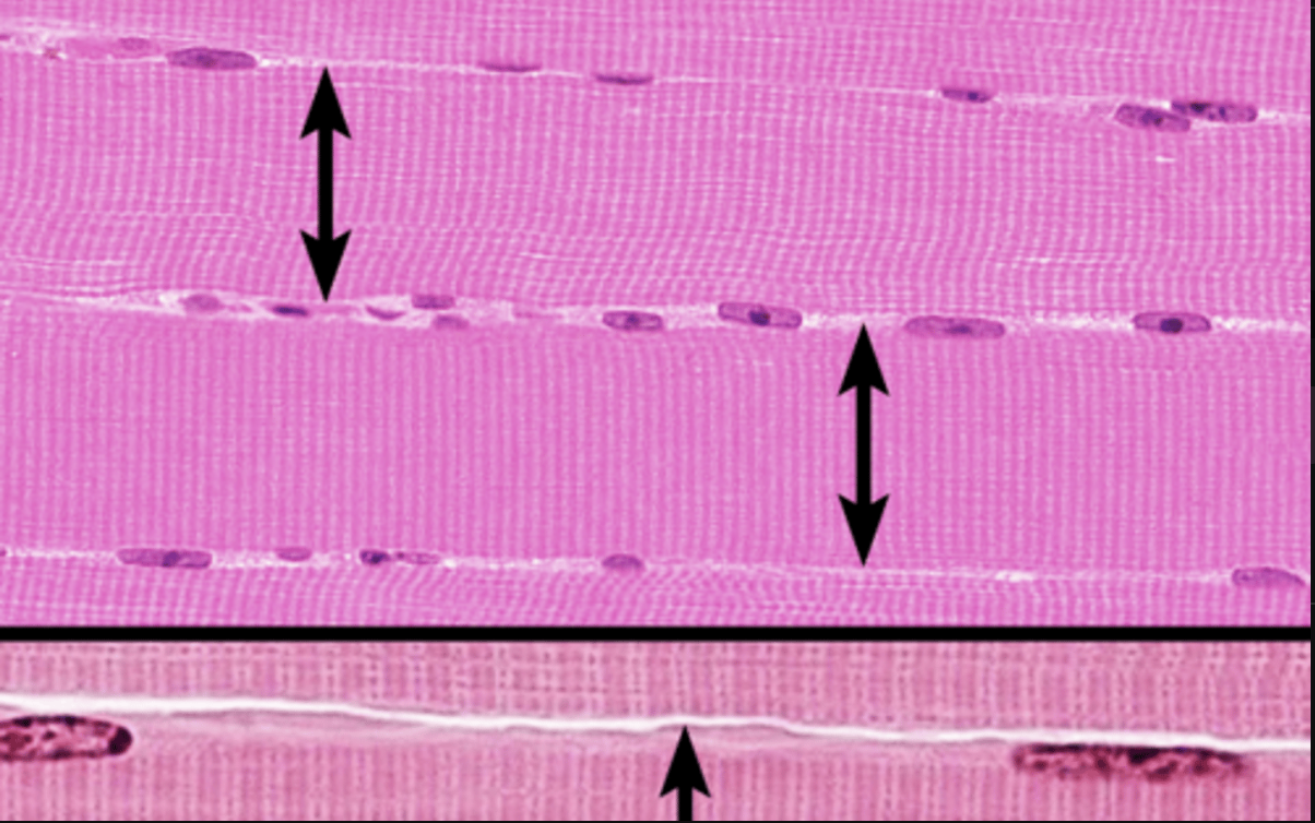 <p>muscle fiber </p>