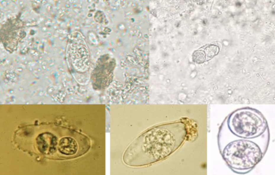 <ul><li><p>oocyst = oval and transparent, 25-35 um</p></li><li><p><span style="background-color: transparent;">The polyvinyl alcohol-preserved sediment makes it difficult to see the oocyst because the cyst wall is very thin and retractile.</span></p></li><li><p><span style="background-color: transparent;">They're variably stained in the modified acid-fast stain; some will stain light pink to purple, while others may remain unstained.</span></p></li><li><p><span style="background-color: transparent;">Their internal structure will not be seen, and some oocysts may appear collapsed or distorted on one side.</span></p></li></ul><p></p>