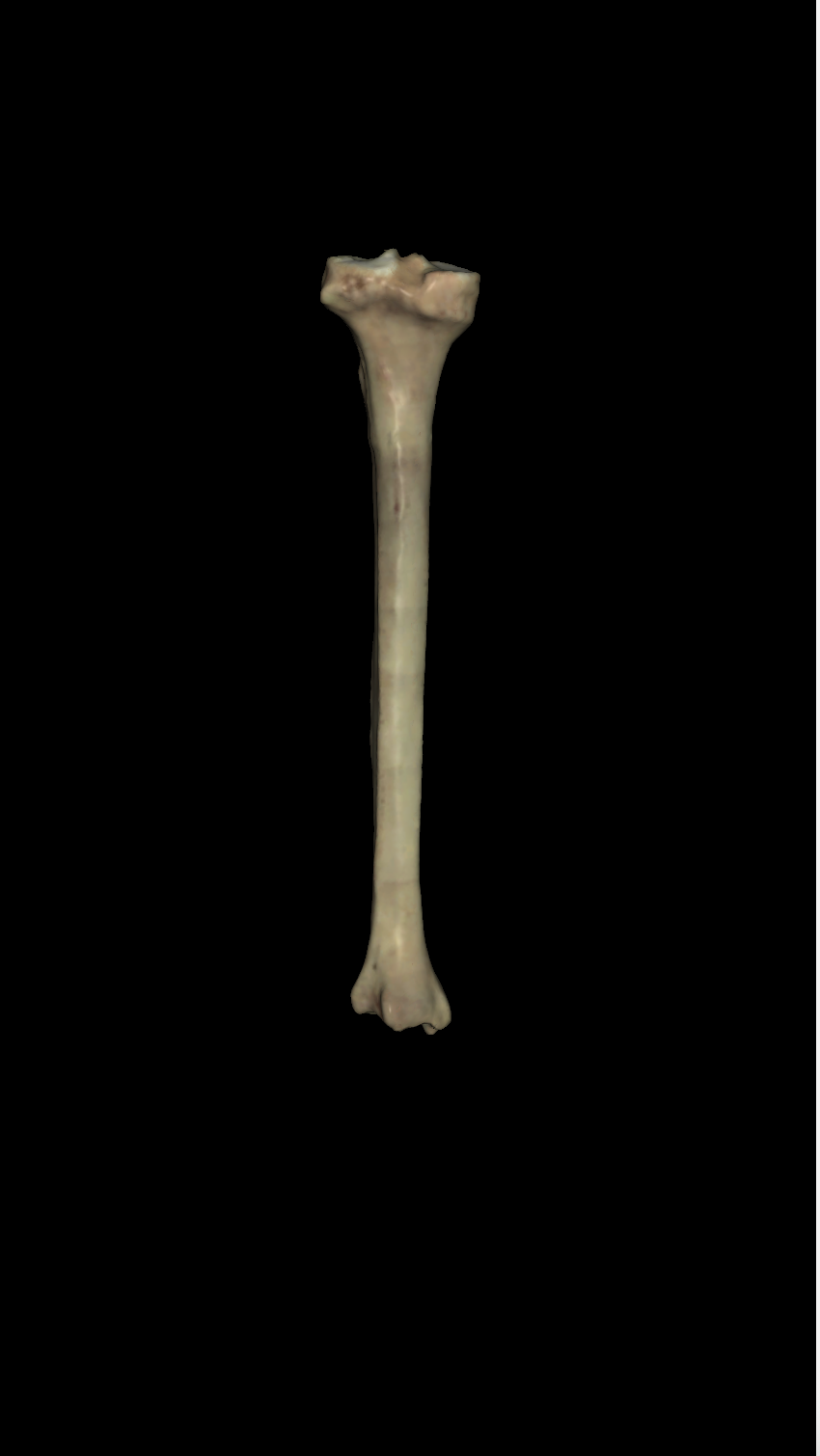 <p>left or right tibia? (posterior view)</p>
