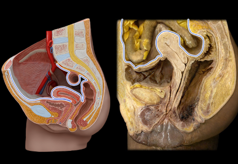 <p>outer lining of abdominopelvic cavity</p>