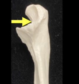 <p>Trochlear notch (ulna proximal end)</p>