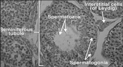 <p>What endocrine organ is this tissue from?</p>