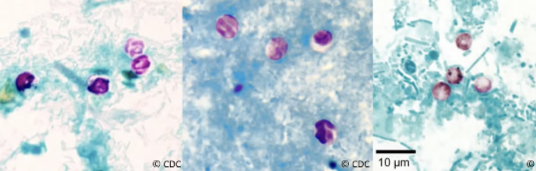 <ul><li><p><span style="background-color: transparent;">often have distinct walls and stain from a light pink to bright red color</span></p></li><li><p><span style="background-color: transparent;">Mature oocyst have discernible sporozoites (up to four), with a blue background and the pink or magenta color staining oocyst, on your modified acid fast stain.</span></p></li><li><p><span style="background-color: transparent;"><strong>the infective form = oocyst</strong></span></p></li></ul><p></p>