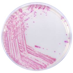 <ul><li><p>agar with chromogens (an artificial substrate) added</p><ul><li><p>some organisms have enzymes that utilize the chromogens and form colored colonies</p></li></ul></li><li><p><strong><em>S. aureus:</em></strong> deep pink-fuchsia on HARDYchrome agar</p></li></ul><p></p>