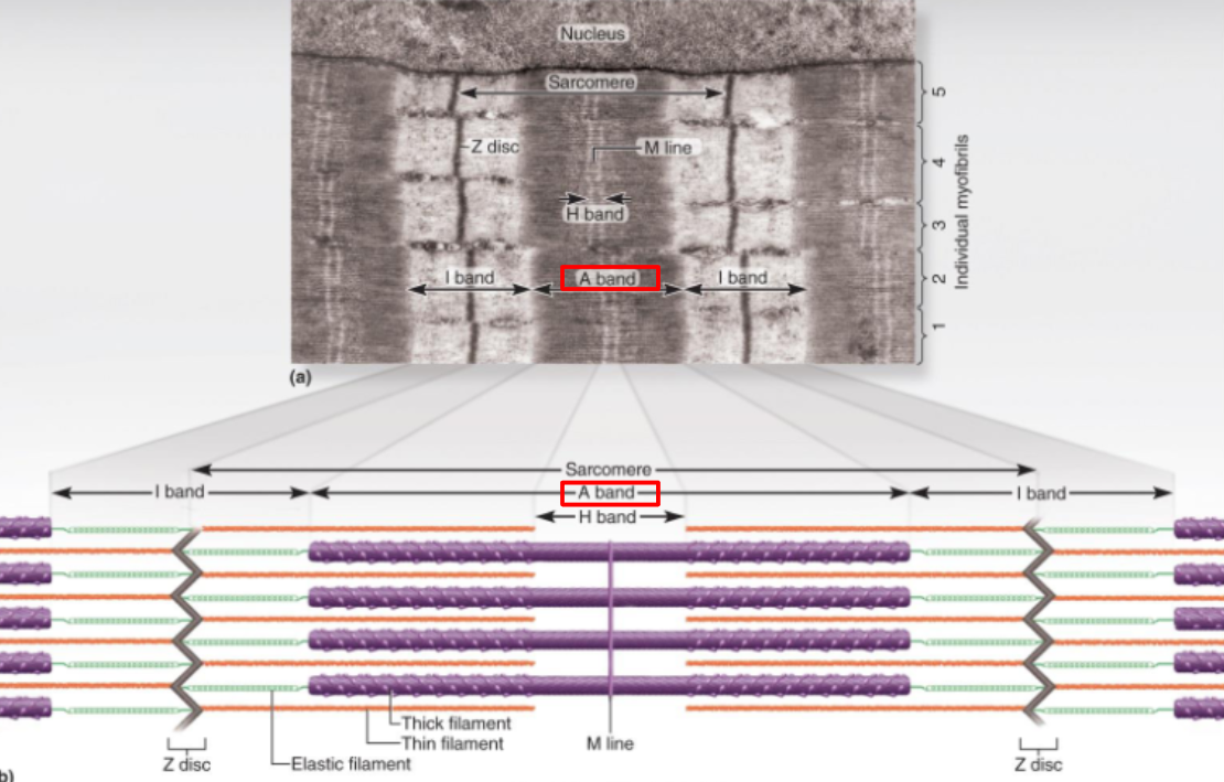 <p>A-bands</p>