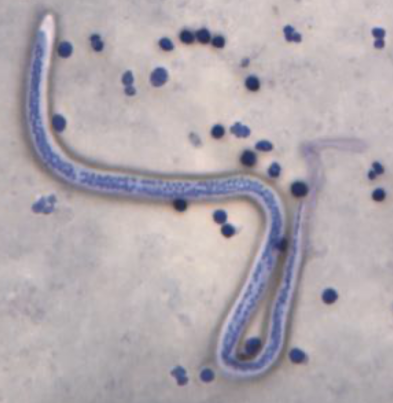 <p>What parasite is this?</p>