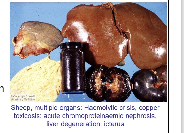 <p>copper toxicosis - haemolytic crisis CS</p>