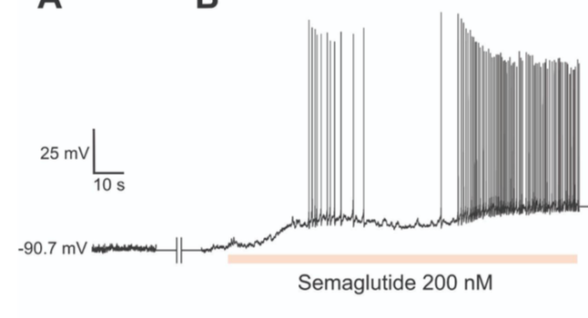 <p>Given the results of ozempic treatment on humans it is likely that the cell whose membrane potential measurements are shown above is a weight loss circuit neuron . If the mechanism of action leading to the results shown involves regulation of a potassium channel, semaglutide signal transduction must lead to the closure of that channel. If the mechanism of action leading to the results shown involves regulation of a sodium channel semaglutide signal transduction must lead to the opening of that channel.&nbsp;</p>