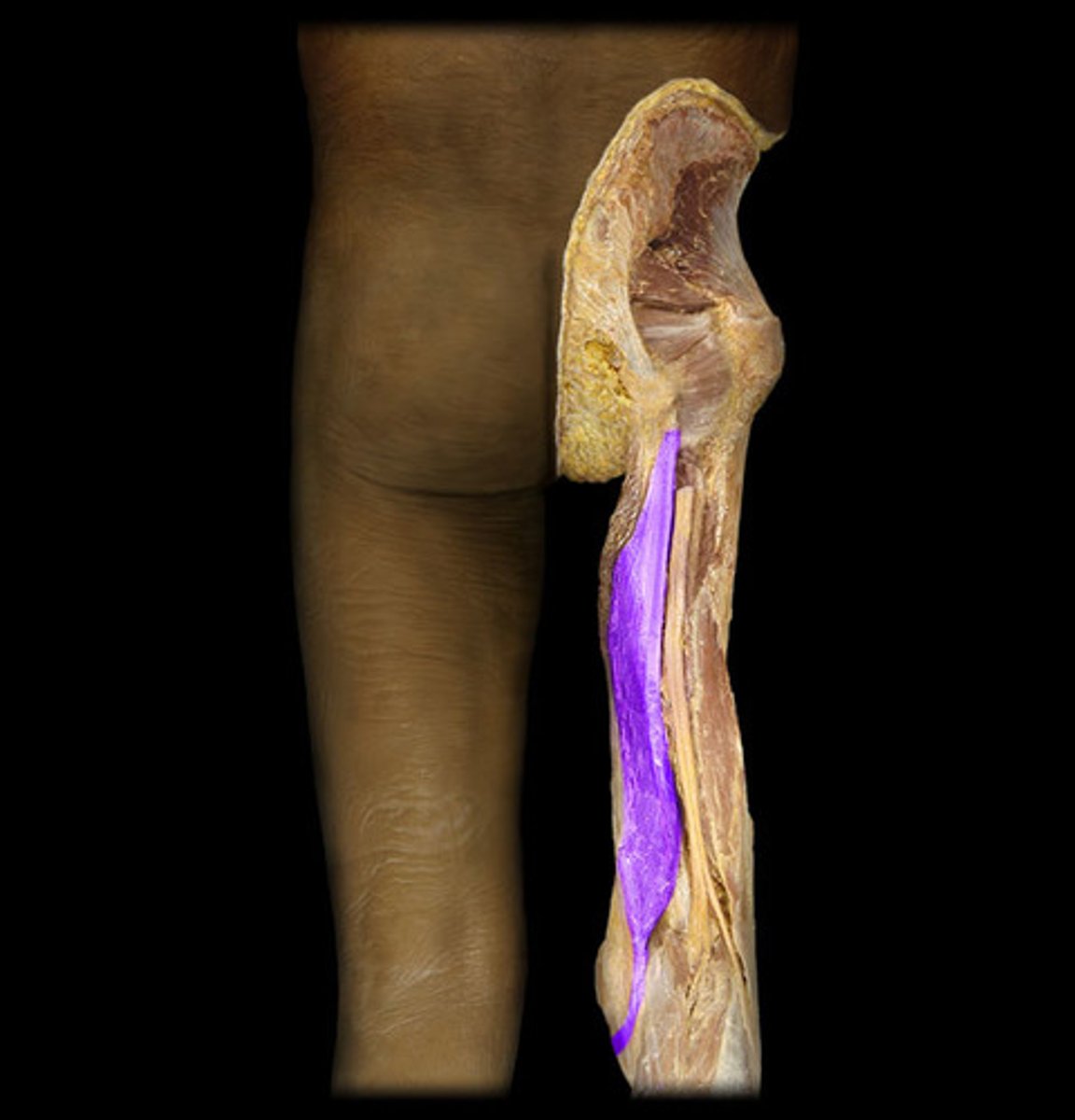 <p>origin: ischium</p><p>insertion: tibia</p><p>action: extends thigh, flexes knee</p>