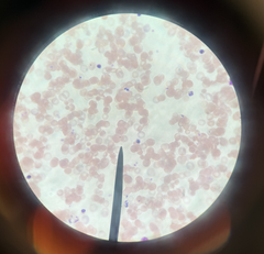 <p>Diatoms, Apicomplexans</p>