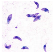 <p>Toxoplasmosis</p>