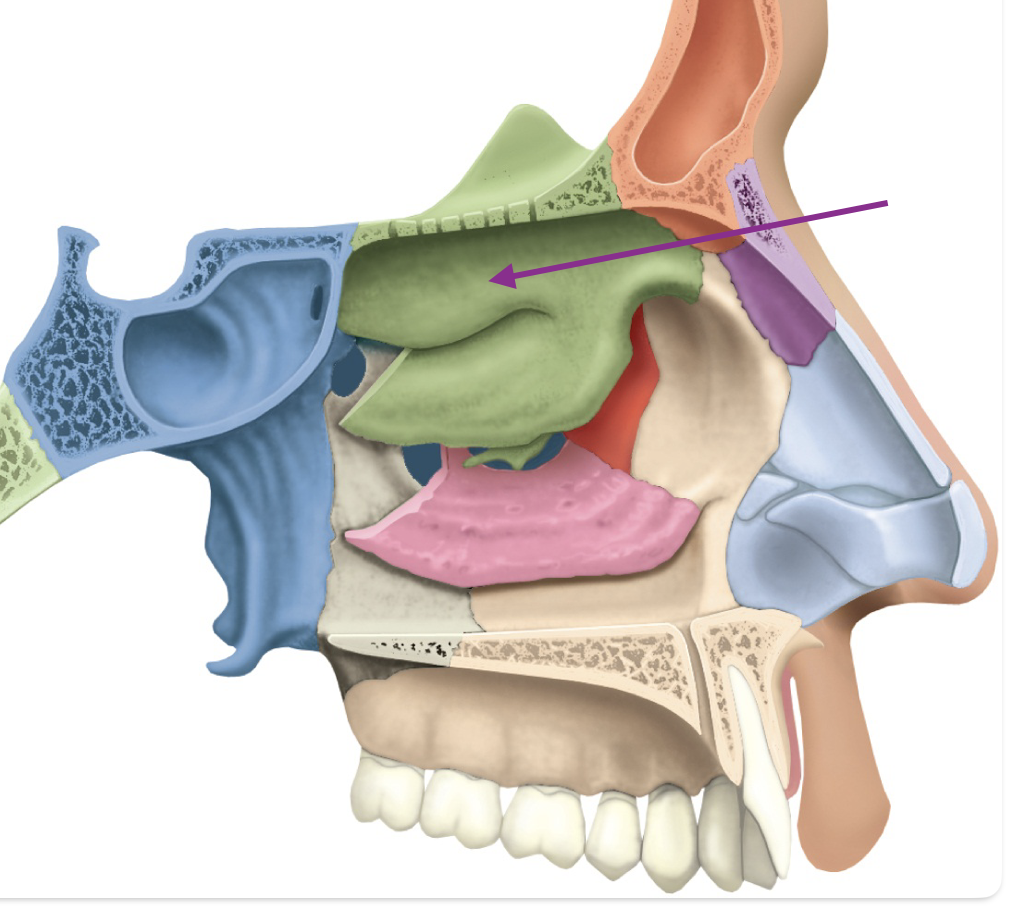 <p>Identify the anatomical feature of the nasal cavity. </p>