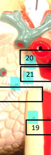 <p>Label this image.</p>