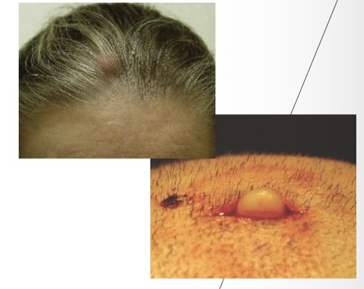 term image