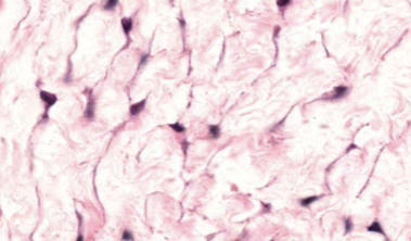 <p>Mucous Connective Tissue (Wharton’s Jelly)</p>