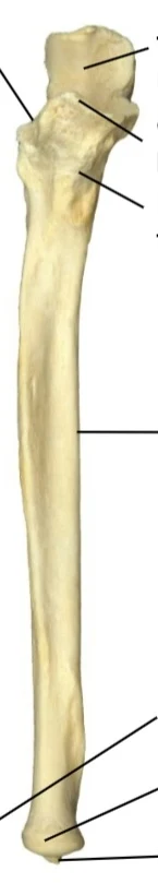 <p>what bone and which way facing</p>