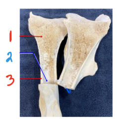 <p>what aspect of this femur is 2</p>