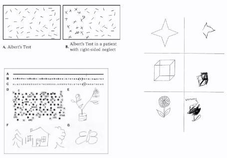 <p>Bisection of lines, Albert’s test (bisecting lots of lines in a box) or copying figures</p>