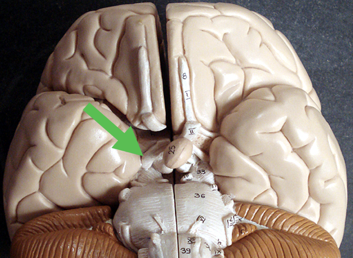 <p>Identify the area of the brain at the tip of the pointer.</p>