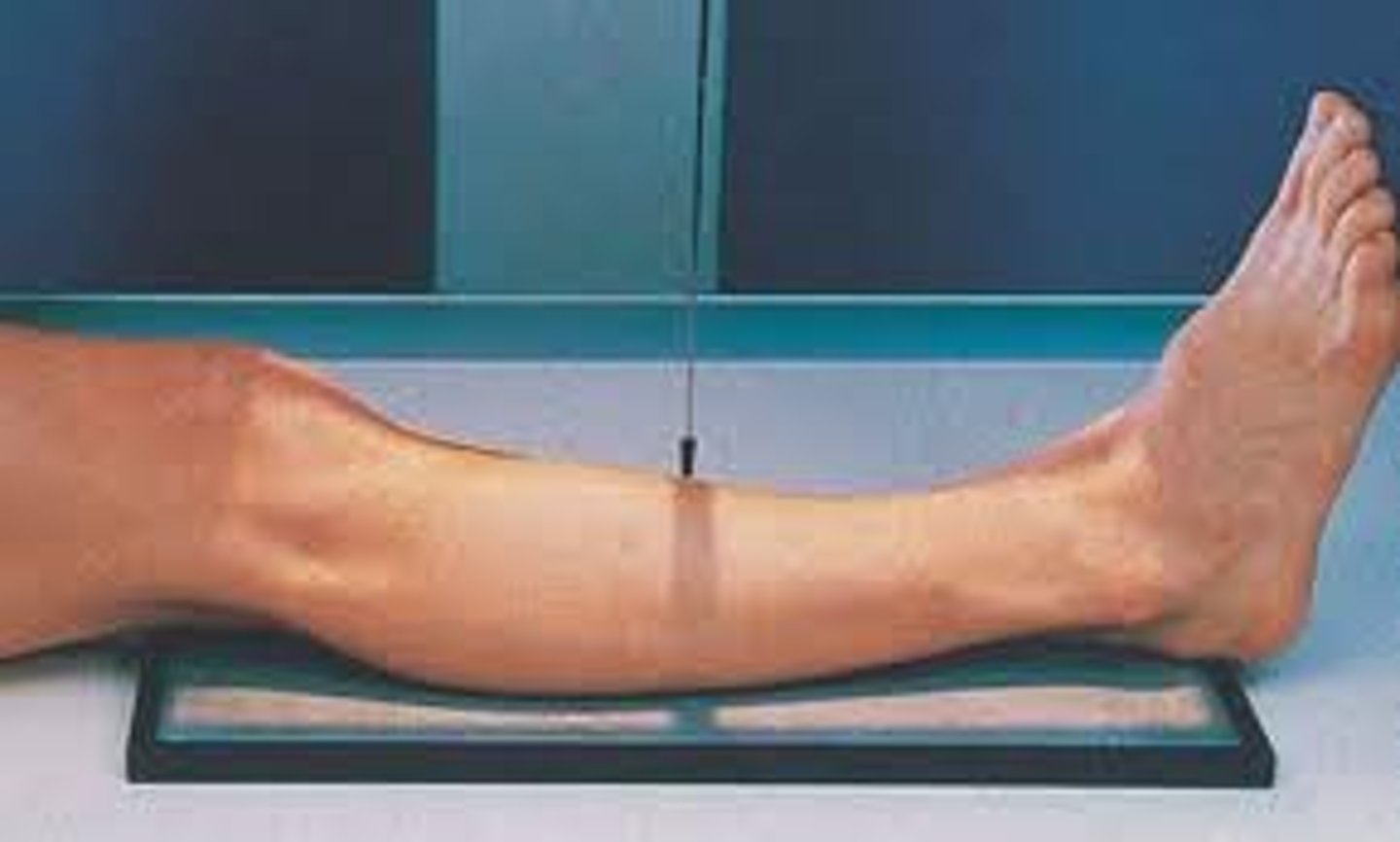 <p>S - on lap</p><p>T - 5 mAs @ 60 kVp</p><p>A - none</p><p>M - correct leg, on cassette</p><p>P - laying down, CR midshaft, include 1-2" above and below joints</p><p>S - 40"</p><p>B - hold</p><p>C - 14 x 17, place behind the thigh and foot (diagonal)</p>